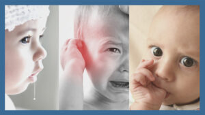 Myofunctional Therapy for Infants and Toddlers